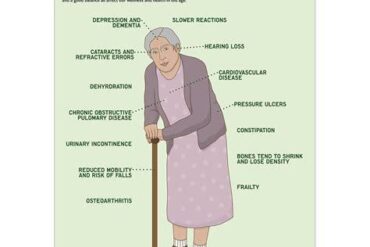 Ageing Effects
