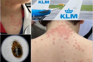 KLM Faces Mounting Scrutiny After Another Bed Bug Horror Story Emerges